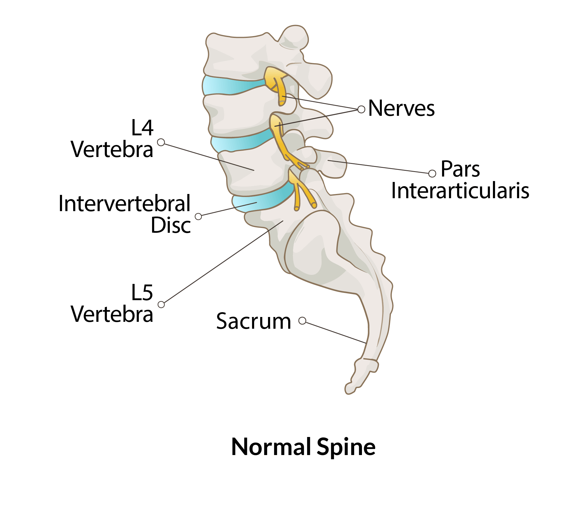 1-Normal Spine @2x Normal Spine - No Spondylolisthesis
